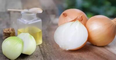 Soğan Suyunun Faydaları Nelerdir?